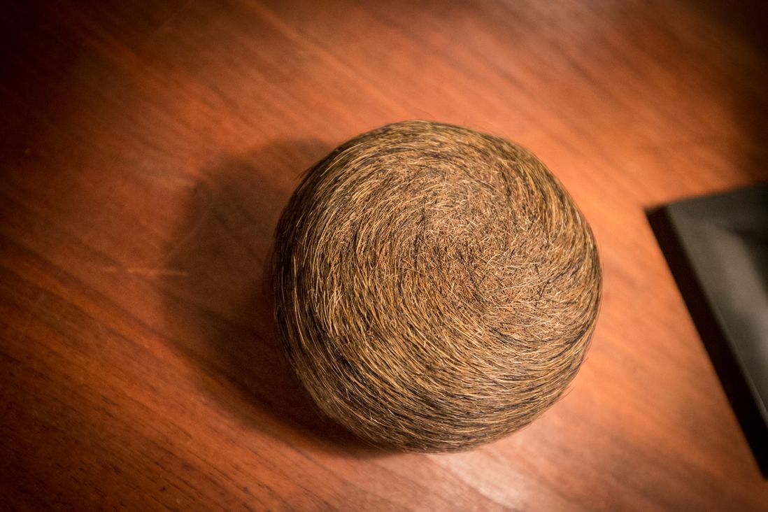 A bezoar (a giant cow or goat hairball). <br/>